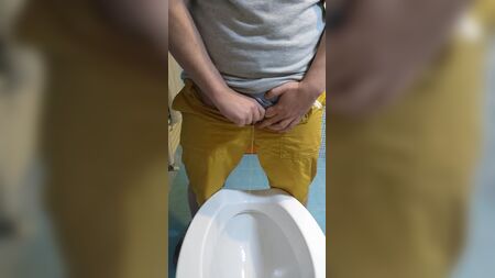 FTM阴茎成形术后站立排尿